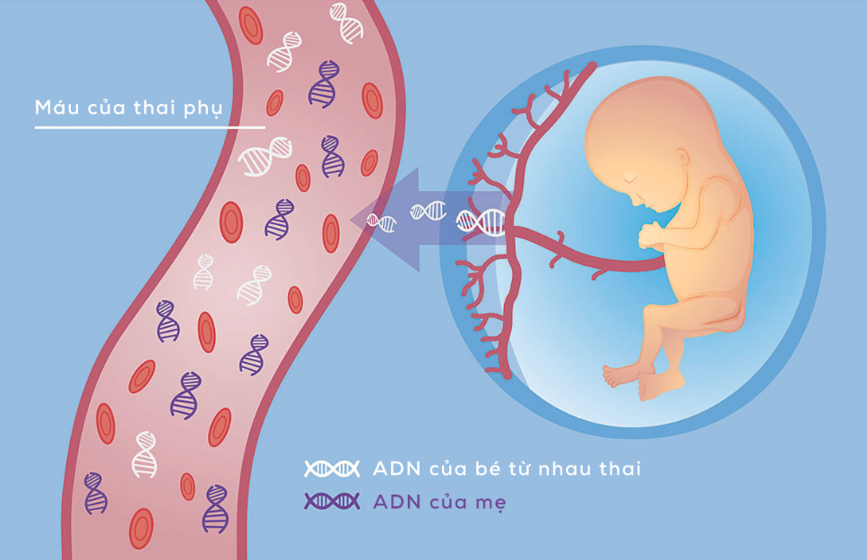 cách đọc kết quả xét nghiệm NIPT